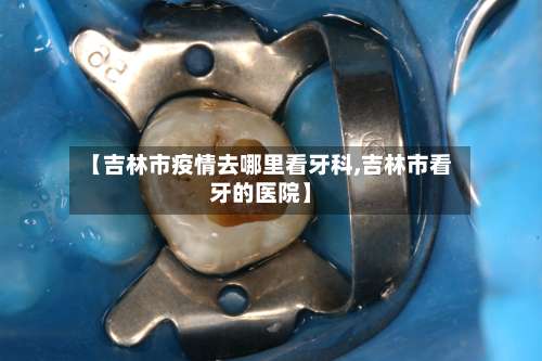 【吉林市疫情去哪里看牙科,吉林市看牙的医院】-第2张图片