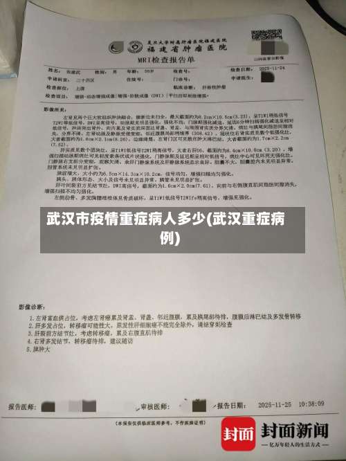 武汉市疫情重症病人多少(武汉重症病例)-第2张图片