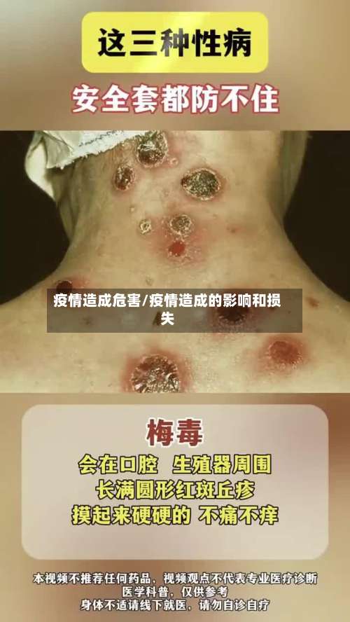 疫情造成危害/疫情造成的影响和损失-第2张图片