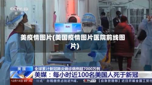 美疫情图片(美国疫情图片医院前线图片)