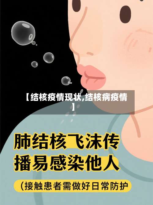 【结核疫情现状,结核病疫情】