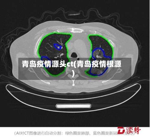 青岛疫情源头ct(青岛疫情根源)-第2张图片