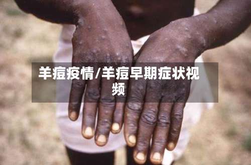 羊痘疫情/羊痘早期症状视频-第3张图片