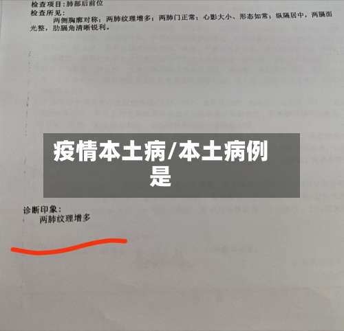 疫情本土病/本土病例是