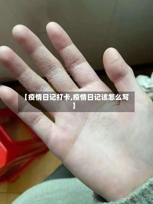 【疫情日记打卡,疫情日记该怎么写】