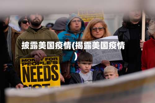 披露美国疫情(揭露美国疫情)