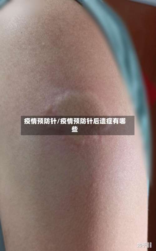 疫情预防针/疫情预防针后遗症有哪些