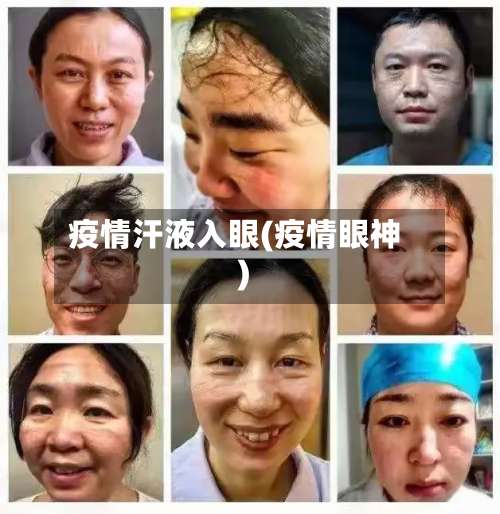 疫情汗液入眼(疫情眼神)