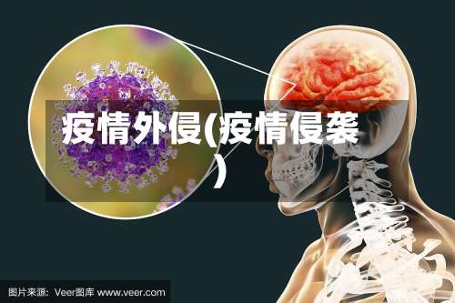 疫情外侵(疫情侵袭)-第2张图片