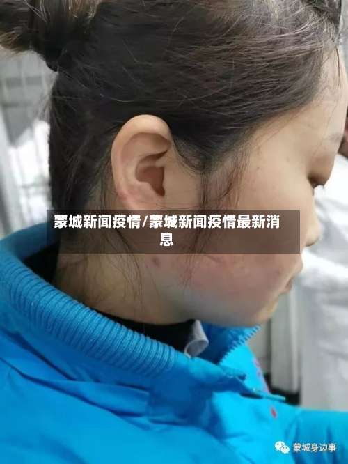 蒙城新闻疫情/蒙城新闻疫情最新消息