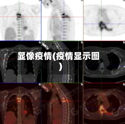 显像疫情(疫情显示图)-第2张图片